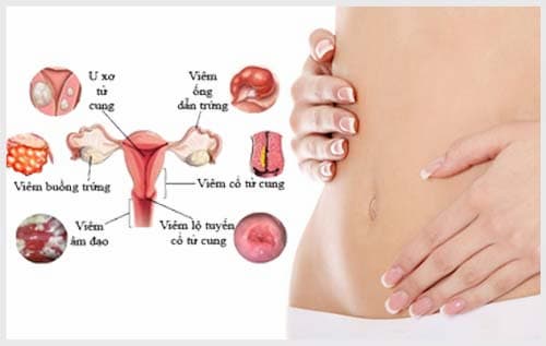 Các bệnh phụ khoa thường gặp