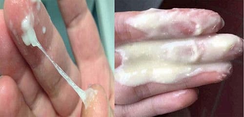 Khí hư màu trắng đục