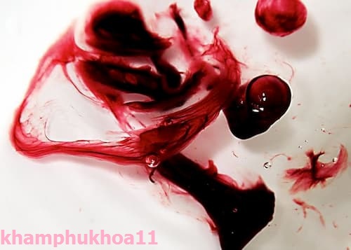 Kinh nguyệt màu đen