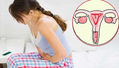 Ung thu cổ tử cung là gì?